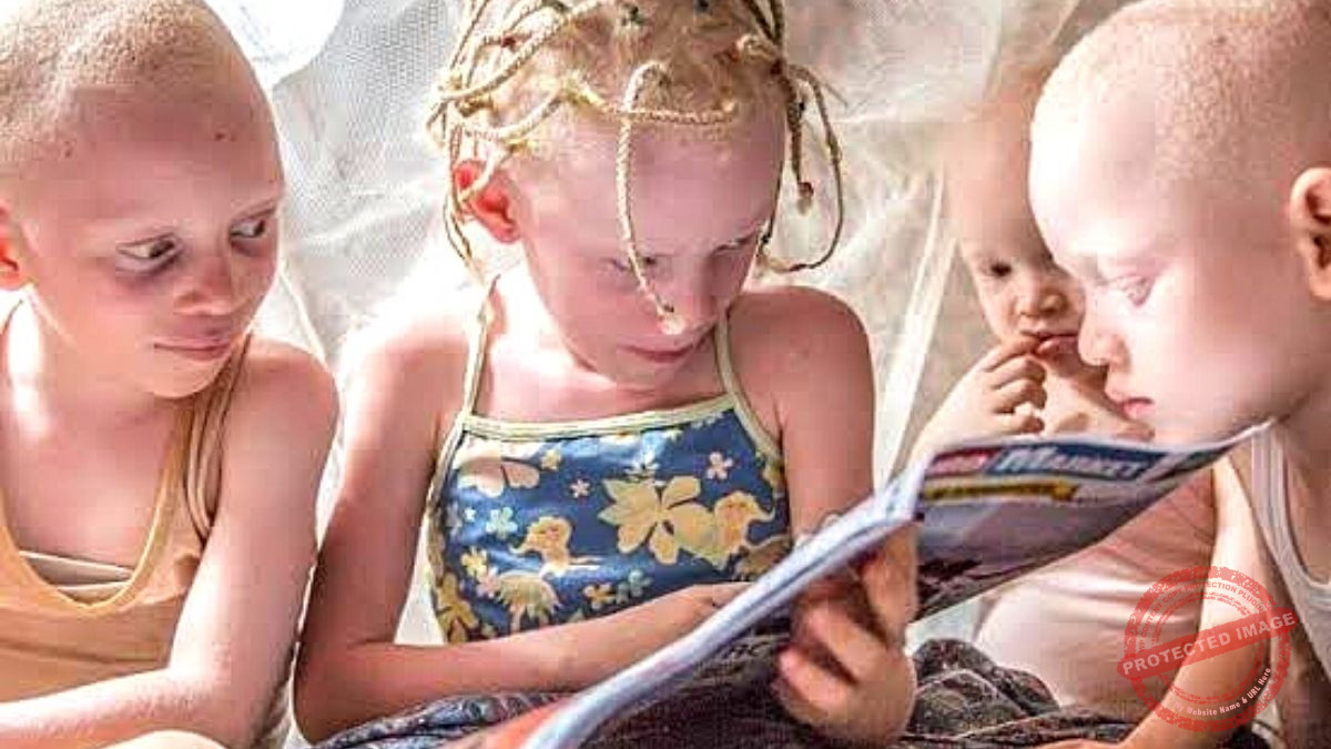 World Albinism Day: Osinbajo Calls for a Reverse of Negative Mindsets on Those Living With Albinism