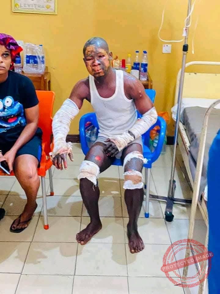 3 Port Harcourt Gas Explosion Victims Die